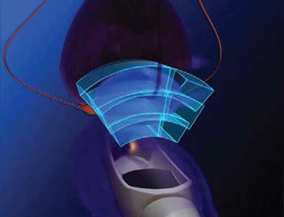 hifu-step2-picture