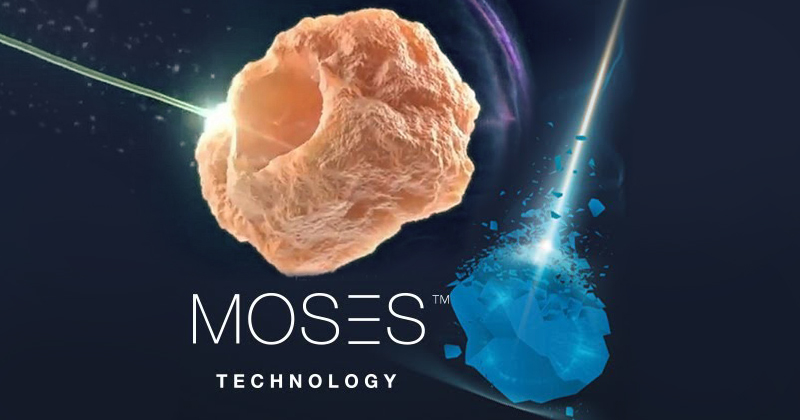 moses-laser-post-image