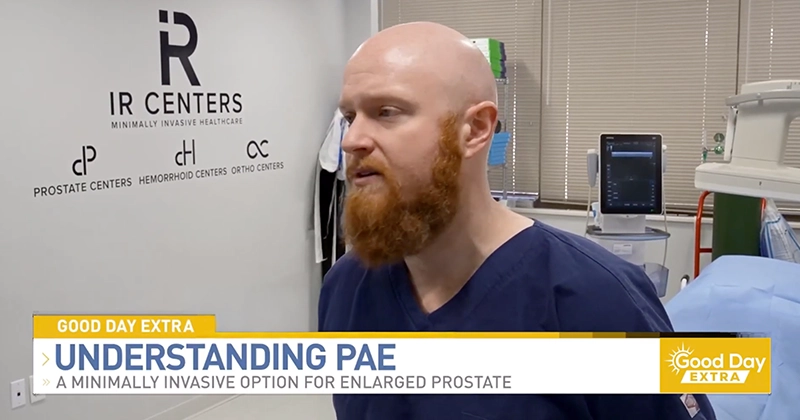 Dr. Jack Ogilvie on Fox28 Show Discussing PAE Treatment for BPH in Interventional Radiology Center